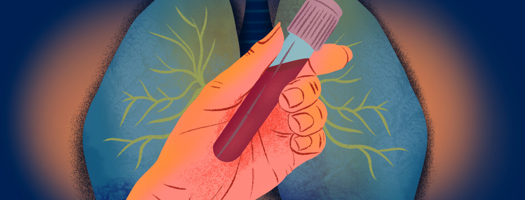Person holding blood sample tube with lungs behind the hand