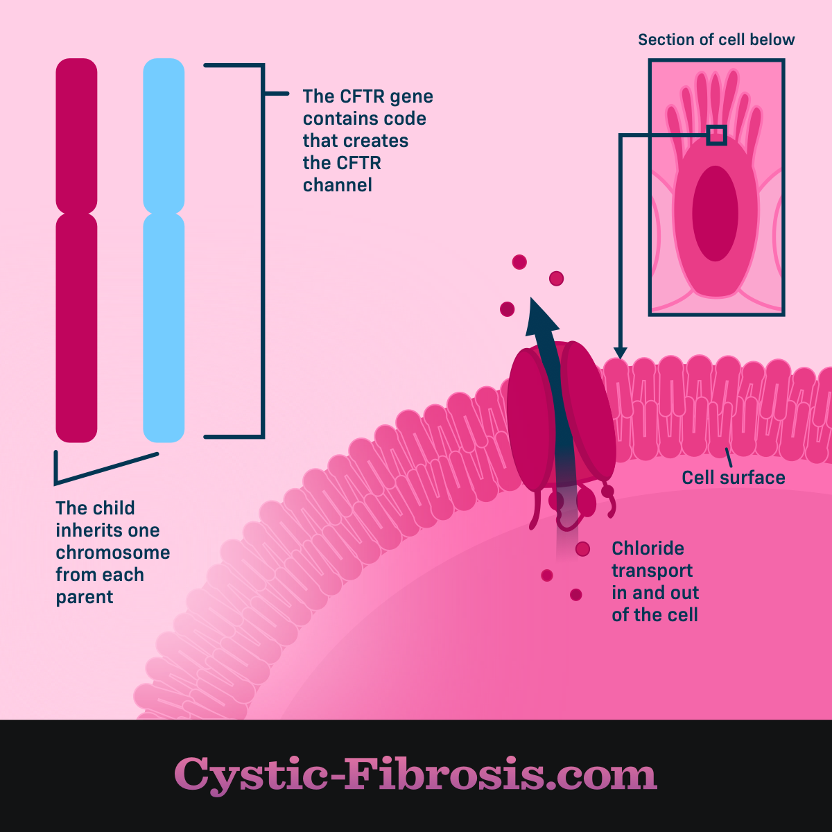 cystic fibrosis chromosome 7